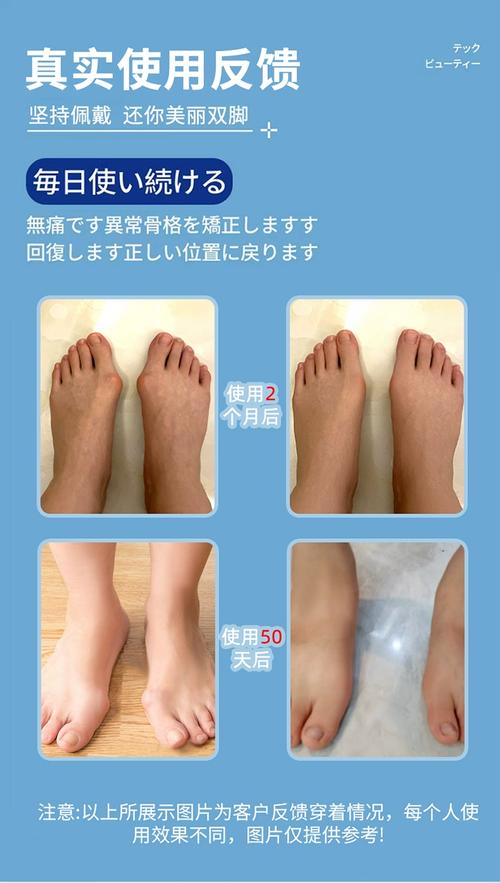 足部護(hù)理全攻略 給雙腳一場(chǎng)溫柔的SPA